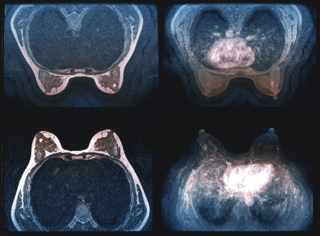 Illustrasjon: Science photo library / NTB Scanpix