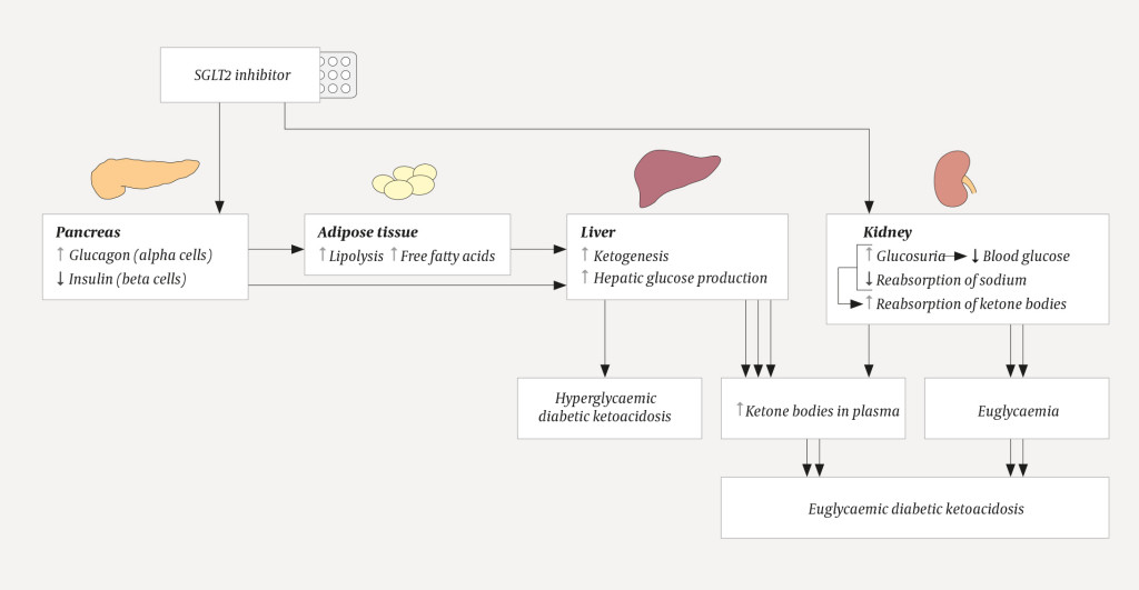 Figure 1 Possible mechanisms underlying SGLT2 inhibitor-induced euglycaemic/hyperglycaemic ketoacidosis, based on Singh (4).