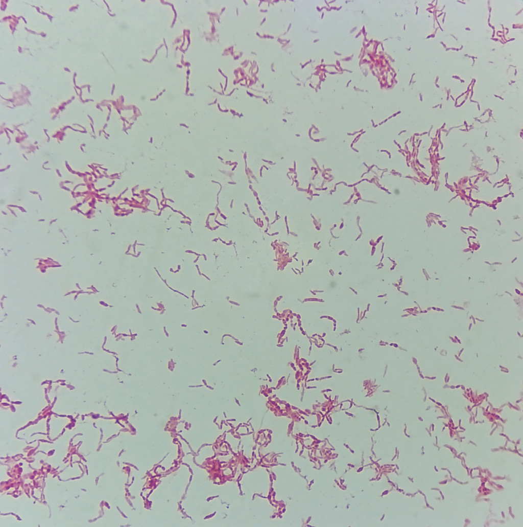 Figure 2 Gram-stained preparation of Streptobacillus moniliformis showing the pleomorphic appearance of the bacterium. Note&hellip;