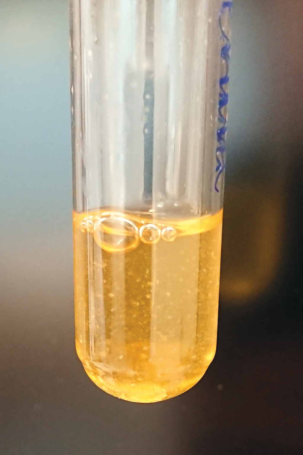 Figure 3 Streptobacillus moniliformis in the growth medium BHI (brain-heart infusion) broth supplemented with 10 % horse&hellip;