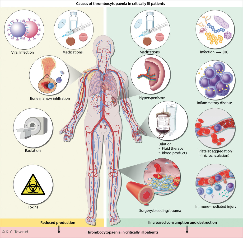 Figure 1 Thrombocytopaenia is common in critically ill patients, and is often the result of several different&hellip;