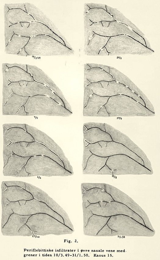 Figure 3 From Marius Haarr's doctoral thesis