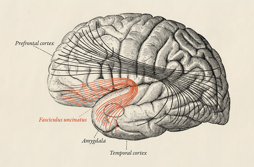 Figur 2 Fasciculus uncinatus er den siste banen i hjernen som myeliniseres, en prosess som ikke er ferdig f&oslash;r personen er i&hellip;