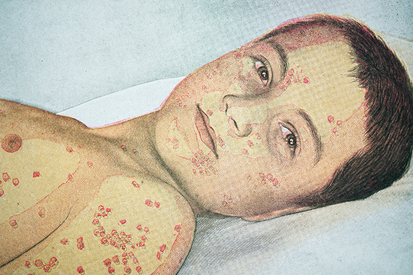 Illustrasjon: VintageMedStock / Alamy Stock Photo