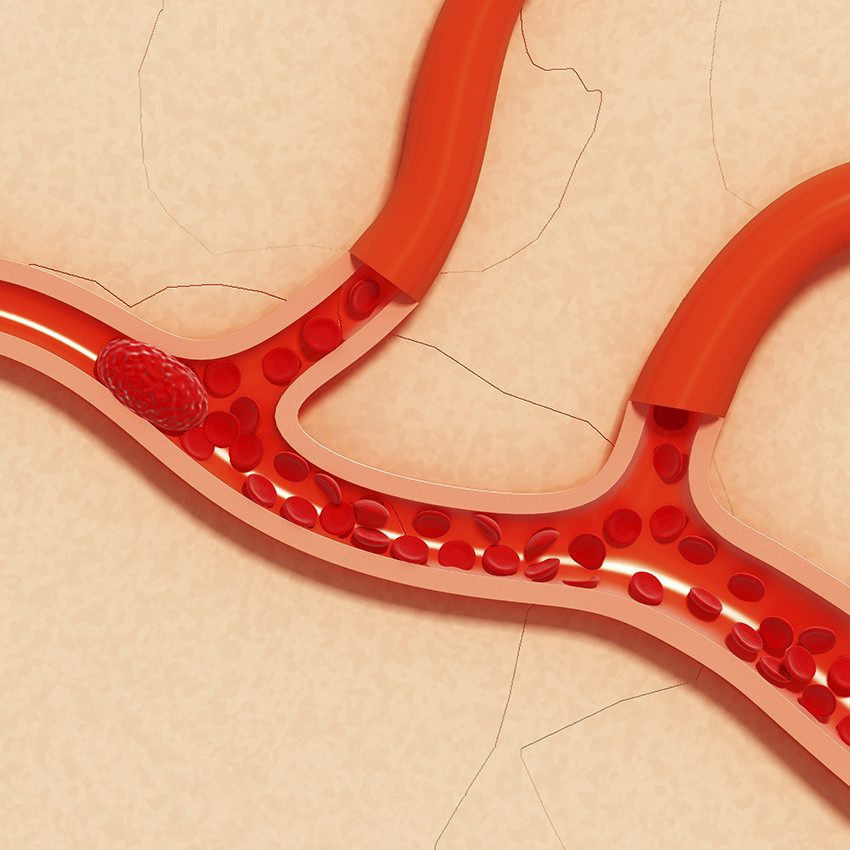 Illustrasjon: Science Photo Library / NTB