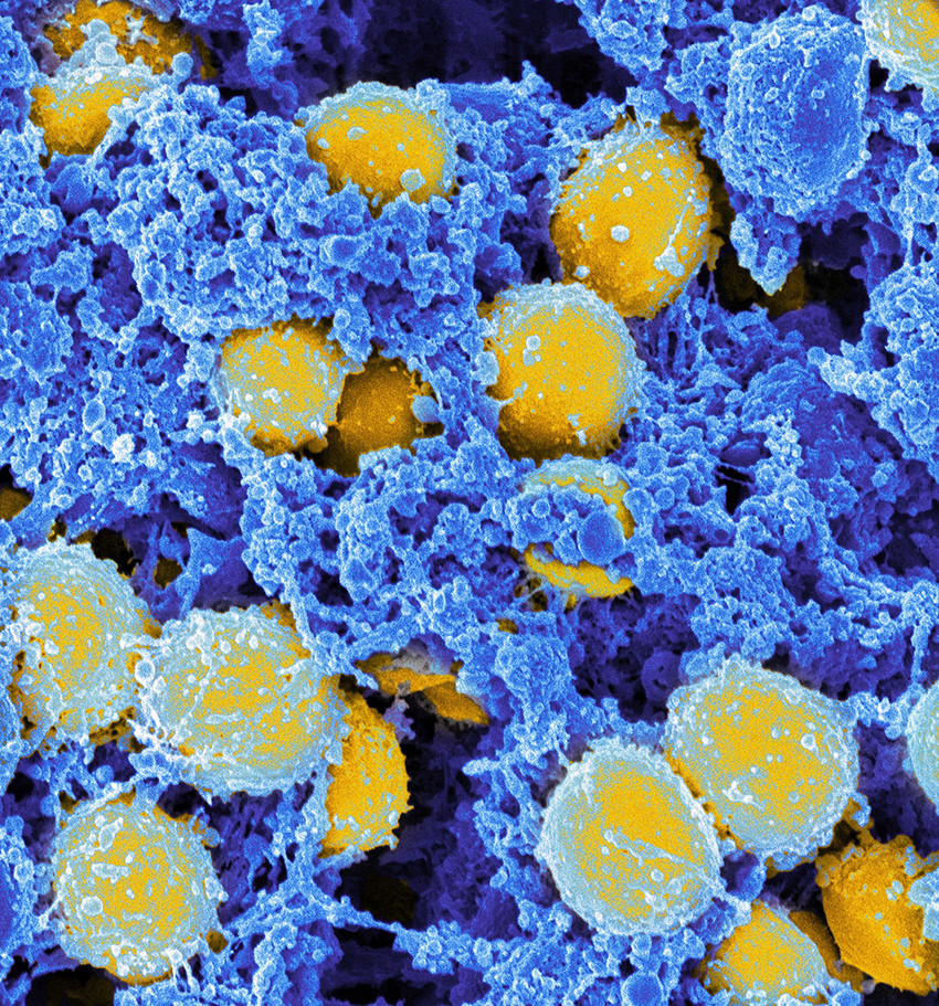 Staphylococcus aureus. Foto: Science Photo Library / NTB