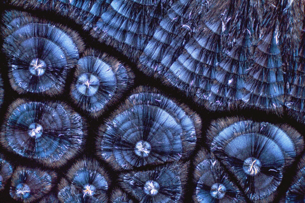 Kolesterolkrystaller sett gjennom polarisasjonsmikroskop. Foto: Science Photo Library / NTB