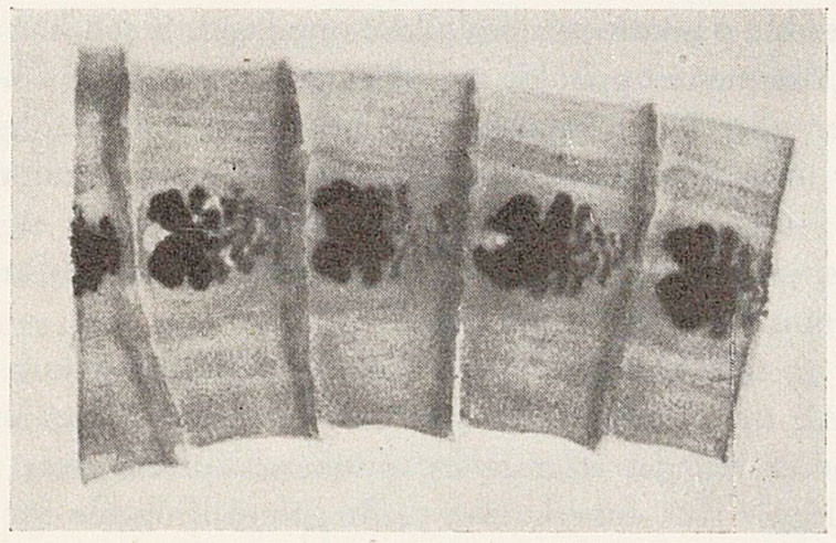 Figur 1 Totalpreparat av fertile ledd med uterus. (Etter preparering.)