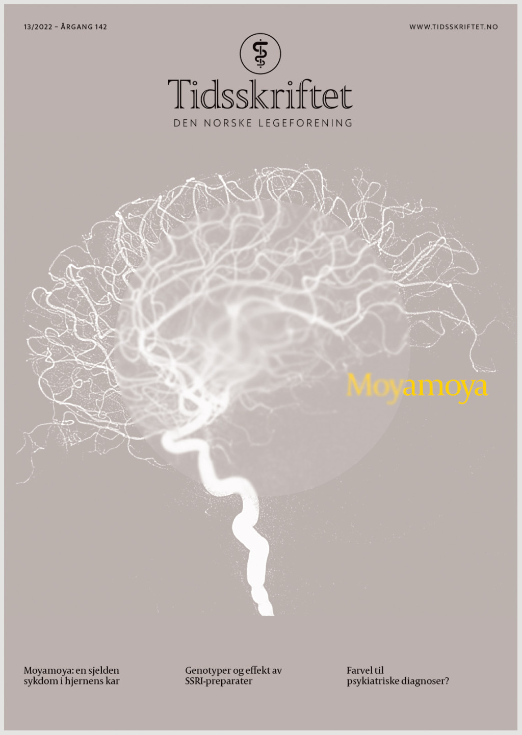 Illustrasjon: Peder Bernhardt&nbsp;