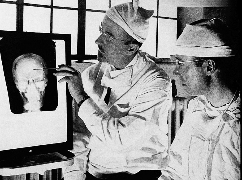 Figure 1 Dr Walter Freeman II (left), and Dr James W. Watts study an X-ray before an operation (2). Photo: Public domain