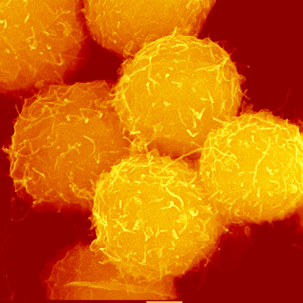 Hematopoetiske stamceller fremstilt ved sveipeelektronmikroskop. Illustrasjonsfoto: Science Photo Library / NTB