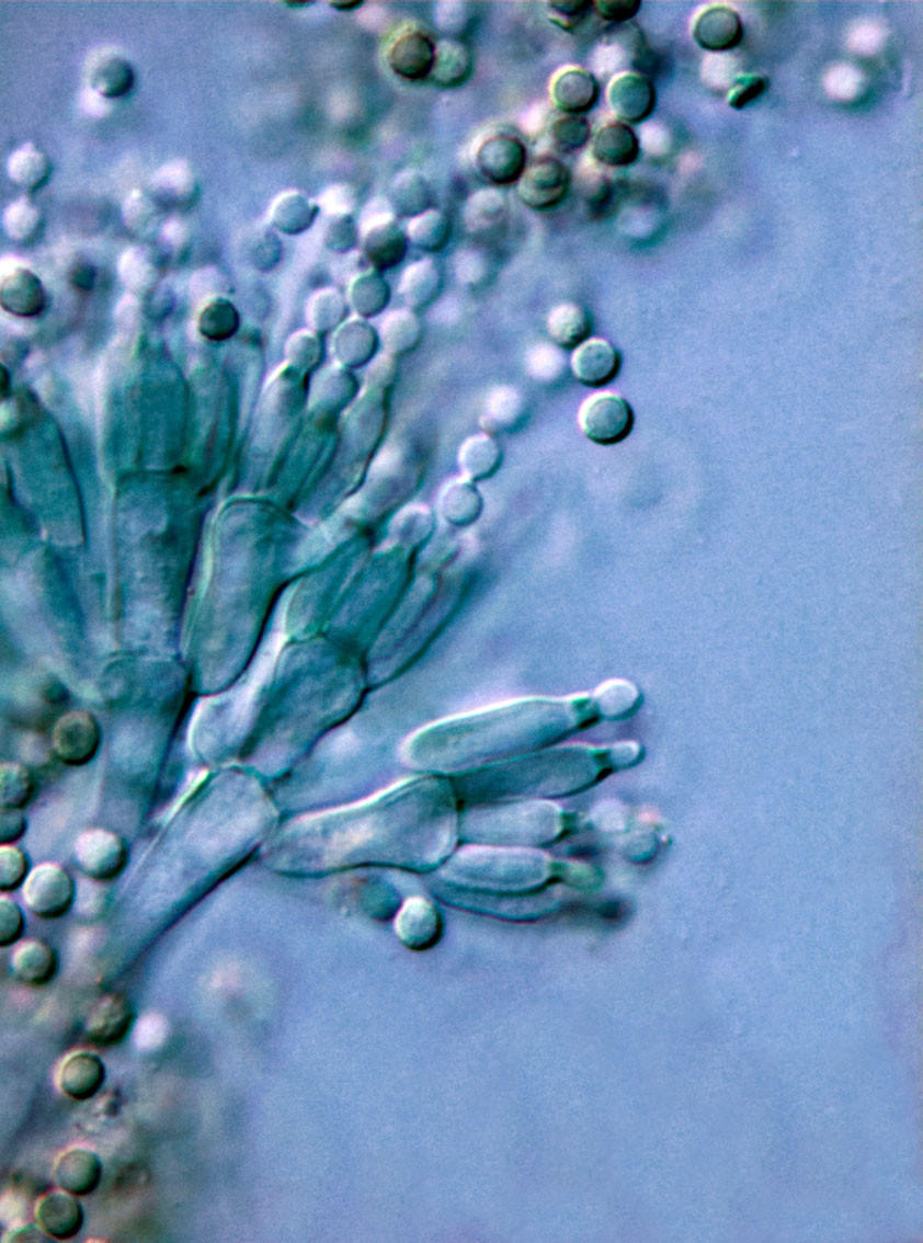 Illustrasjonsfoto: alanphillips/iStock