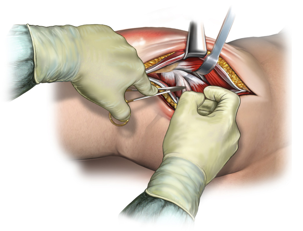Illustrasjon: Science photo library / NTB Scanpix