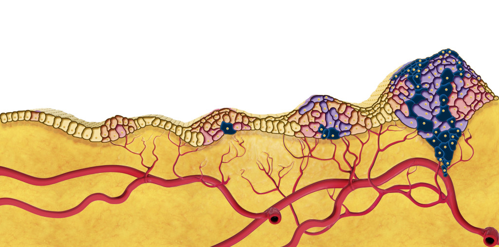 Illustrasjon: Science photo library / NTB Scanpix