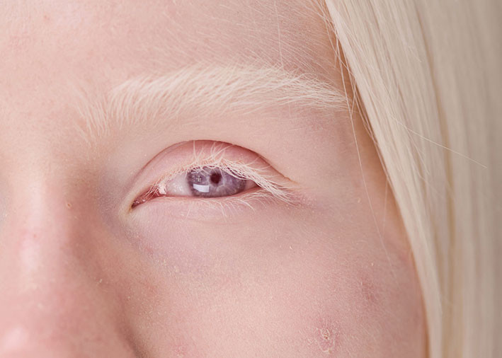 Photo: AnnaStills/iStock. Adapted by the Journal of the Norwegian Medical Association