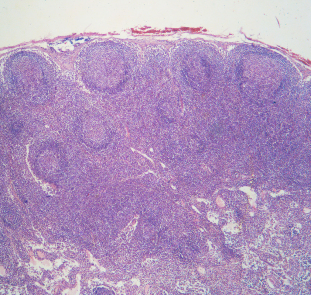 Lymfeknute, utsnitt fra hematoksylin-eosin-farget preparat som fra toppen og nedover viser kapsel, cortex med follikler,&hellip;