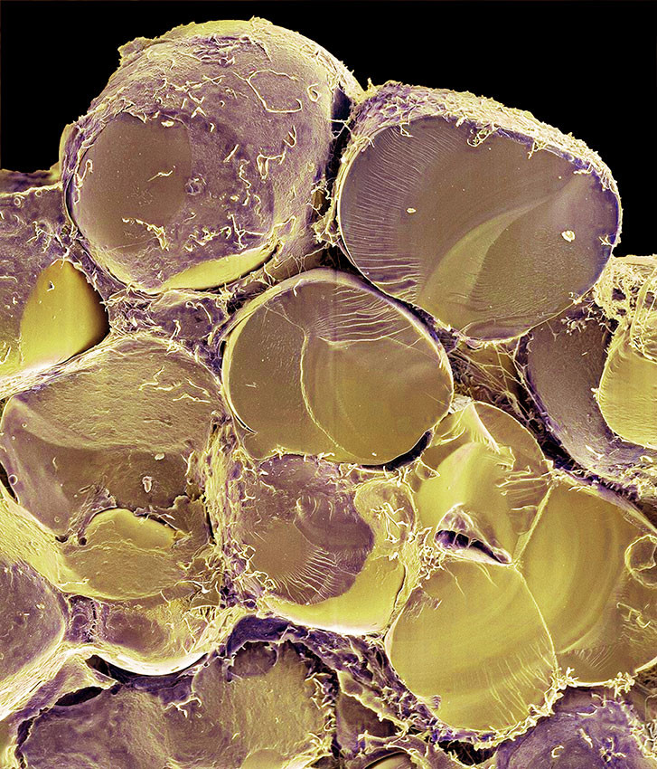 Fettceller, skanningelektronmikroskopi (SEM). Illustrasjon: Steve Gschmeissner / Science Photo Library, via NTB