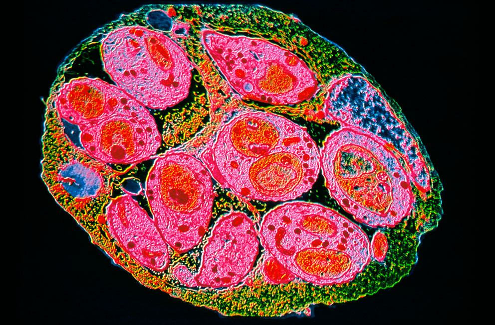 Farget transmisjonselektronmikroskopbilde av en celle infisert med Toxoplasma. Illustrasjon: Science Photo Library / NTB