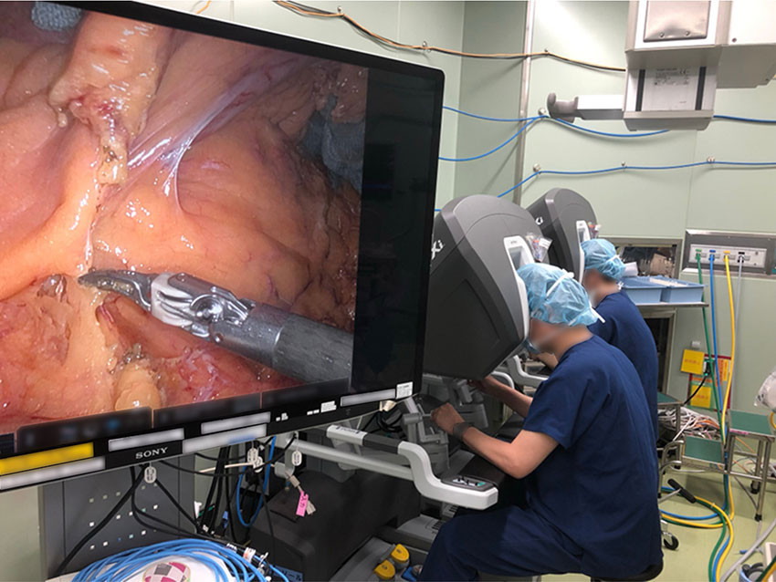 Figure 1 Robotic surgery with two consoles at the Cancer Institute Hospital in Tokyo. An experienced surgeon (proctor)&hellip;