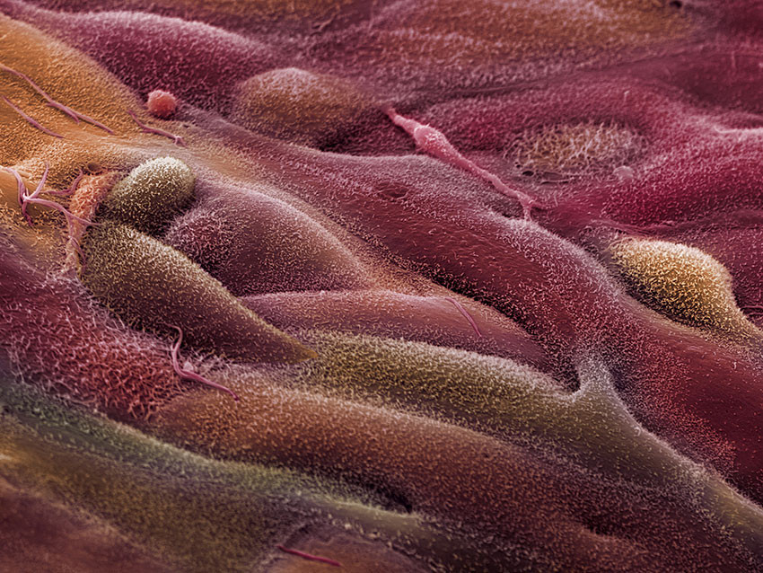 Eggstokkcelle kledd med epitel sett ved farget elektronmikroskop. Foto: Science Photo Library / NTB