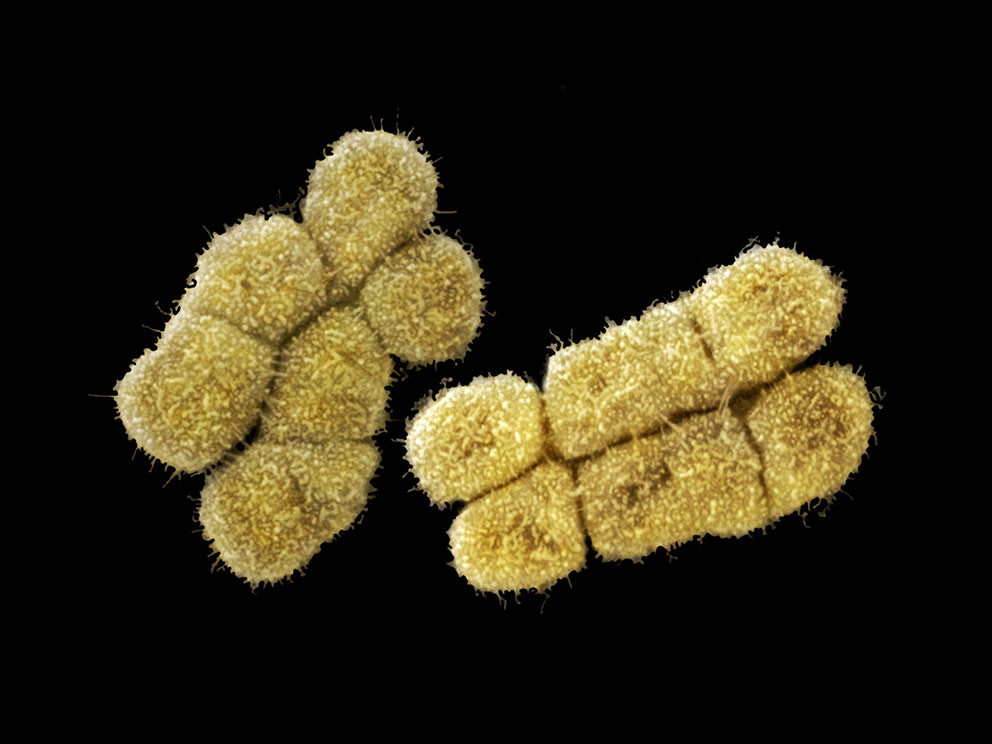 Farget elektronmikrografi (SEM) av kromosompar 4. Foto: Science Photo Library / NTB