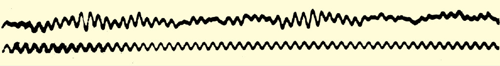 Den f&oslash;rste EEG-m&aring;lingen. Illustrasjon: I offentlig eie.