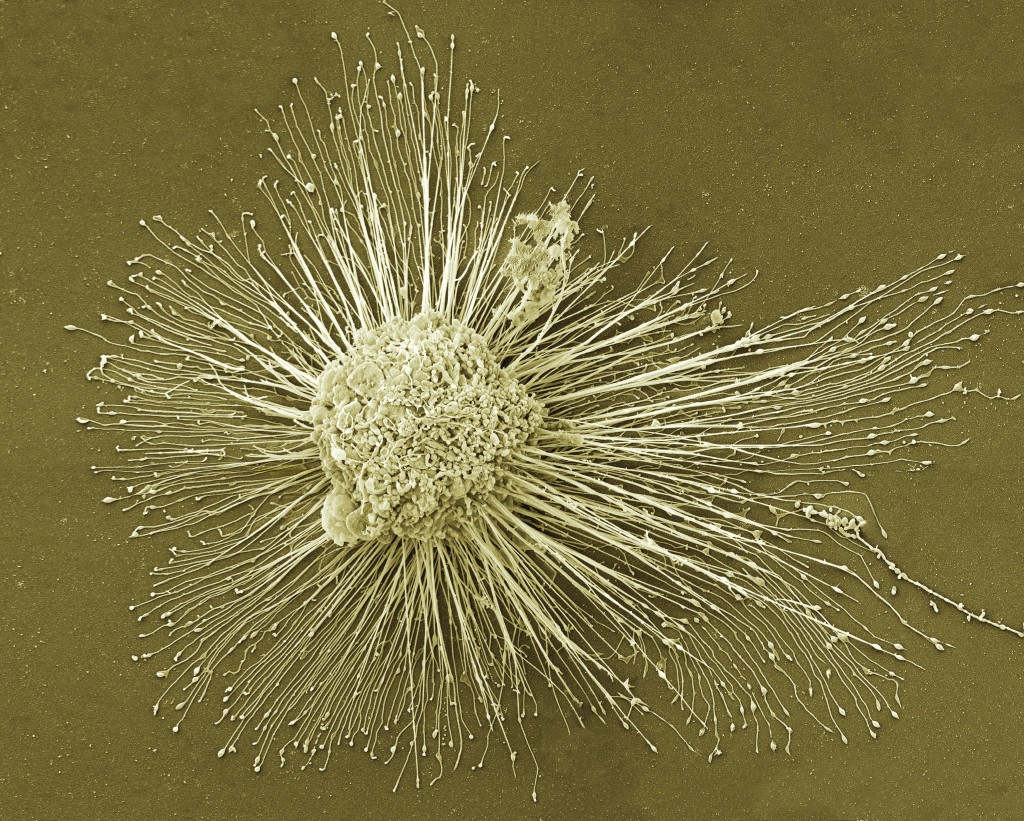 Farget skanningelektronmikroskopi (SEM) av en indusert pluripotent stamcelle (magnifikasjon: &times;2500). Foto: Science Photo&hellip;